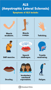 The Continuing Challenges of&nbsp;ALS